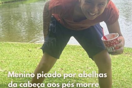 Menino picado por abelhas da cabeça aos pés morre em hospital ! Menino picado por abelhas da cabeça aos pés morre em hospital !